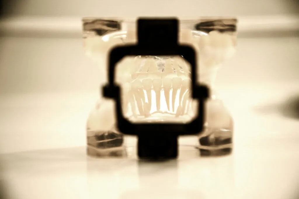 Schnarchschiene Köln: Transparente Protrusionsschiene auf einem Kiefermodell bei Marquardt Dentists