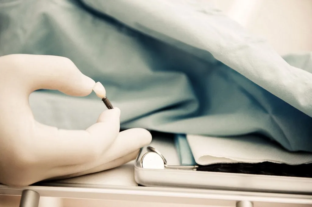 Marquardt Dentist ist eine der Top Adressen in Köln für festen Zahnersatz fester-zahnersatz-koeln